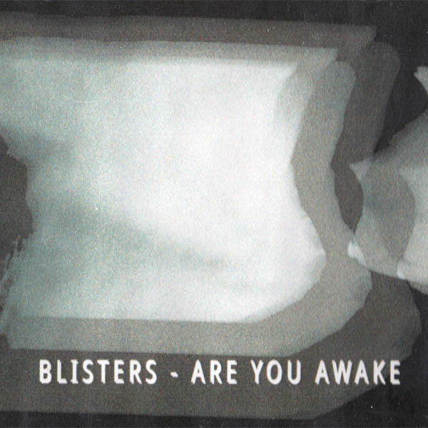 Weird_Canada-Blisters-Are_You_Awake